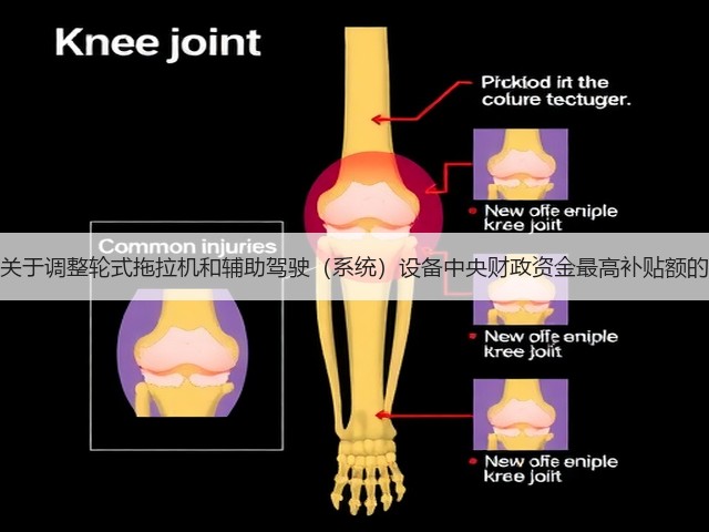 新疆关于调整轮式拖拉机和辅助驾驶（系统）设备中央财政资金最高补贴额的通知(图2)