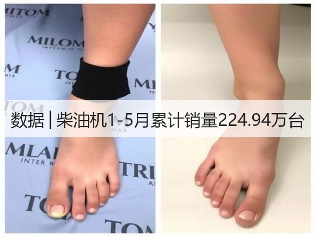 数据│柴油机1-5月累计销量224.94万台(图3)